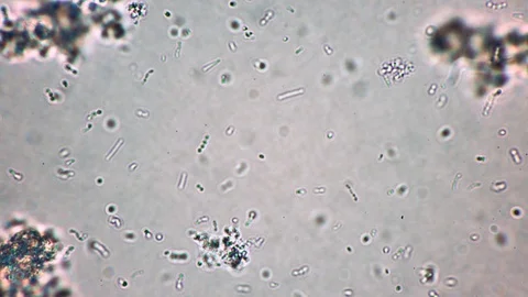 Many small bifid bacterium are moving in fermented dairy product in Stock Footage 129815954
