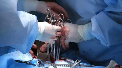 Many Surgical Instruments in Usage Stock Footage 75407635