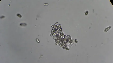 Many wild infusoria under microscope Video stock 33661733