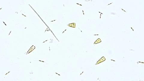 Marine diatom algae under the microscope Stock Footage 276661375