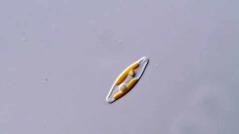 Marine Diatoms Under Compound Microscope 스톡 동영상 317253993