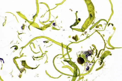 Marine green microalgae under the microscope in front of a white background Stock Photos