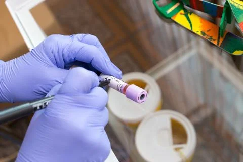 Marking blood test Stock Photos