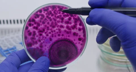 Marks colonies in a Petri dish with a marker Stock Footage 292912755