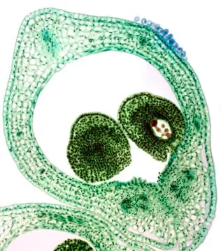 Marsh marigold carpel, light micrograph Stock-Fotos