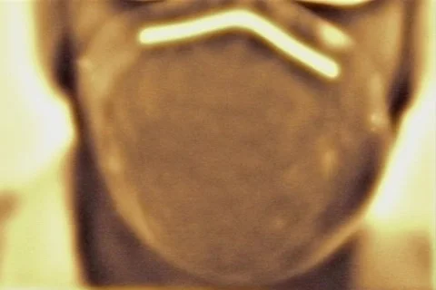 Mask 스톡 동영상 113430