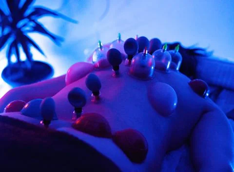 Massage jars placed on the back Stock Photos
