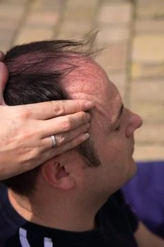 Massage to the temples Stock Photos