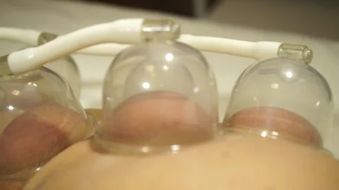 Massage using pneumatic suction cups Video stock 195296676