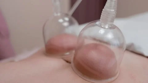 Masseur makes vacuum massage with flasks. Close-up shot. Body care.  Stock Footage 232860707