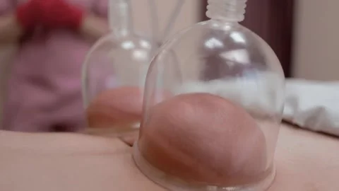 Masseur makes vacuum massage with flasks. Close-up shot. Body care. Stock Footage 232860762
