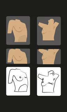 Mastectomy Stock Illustration