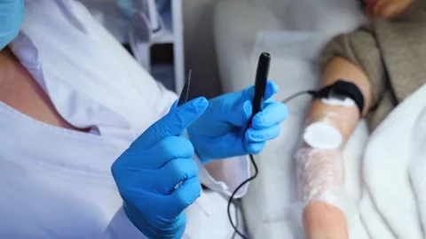 A master performs an electrodepilation procedure on a girl's arm Stock Footage 270173647