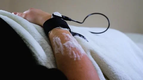 A master performs an electrodepilation procedure on a girl's arm Stock Footage 270173649
