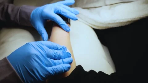 A master performs an electrodepilation procedure on a girl's arm Stock Footage 270173691