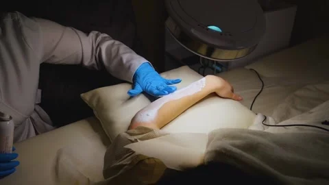 A master performs an electrodepilation procedure on a girl's arm Stock Footage 270173696