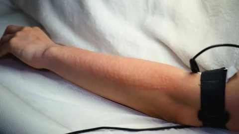 A master performs an electrodepilation procedure on a girl's arm Stock Footage 270173741