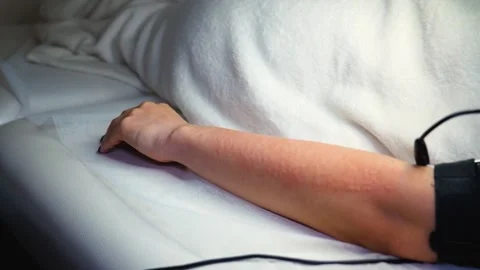 A master performs an electrodepilation procedure on a girl's arm Stock Footage 270173754