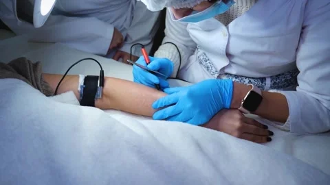 A master performs an electrodepilation procedure on a girl's arm Stock Footage 270173771