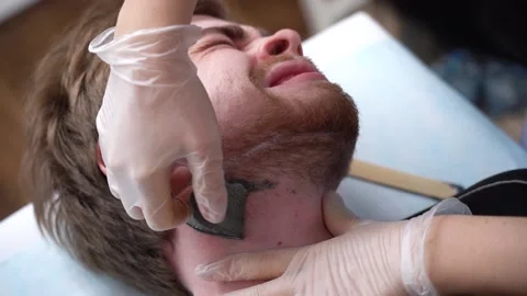 Master performs procedure removing  facial hair in bearded man  wax on neck Vidéo 149483071