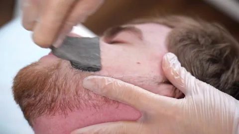 Master performs procedure removing unwanted facial hair in bearded man with wax. Stock Footage 149584441
