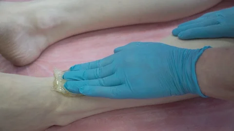 Master of shugaring process of hair removal with sugar on his legs Stock Footage 87475737