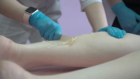 Master of shugaring process of hair removal with sugar on his legs Stock Footage 87475875