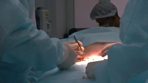 Mastership of the surgeon in the operation. Stock Footage 83194635