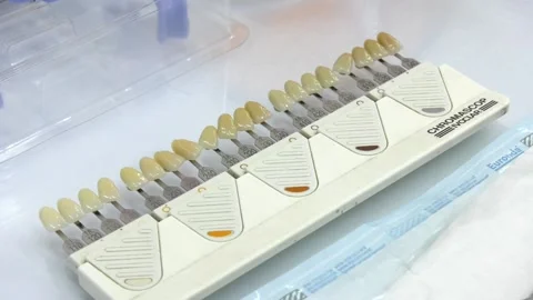Matching the shades of the implants or the process of teeth whitening. Video stock 106774106