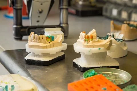 Materials for dental prostheses Stock Photos