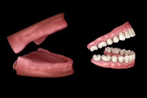 Maxillary and Mandibular prosthesis, artificial dentures. Medically accurate Stock Illustration