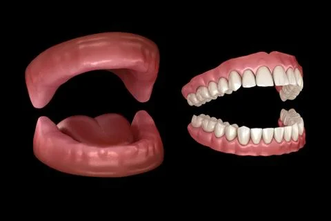 Maxillary and Mandibular prosthesis, artificial dentures. Medically accurate Stock Illustration