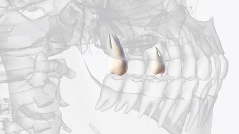 The maxillary third molar is the most distal tooth in the arch and anatomical Stock Illustration