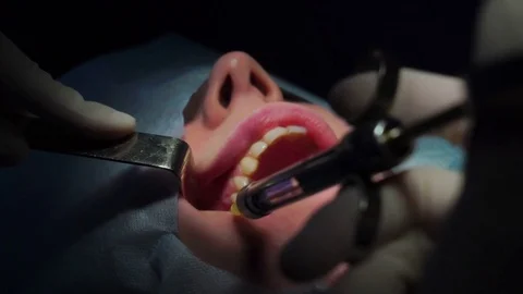 Maxillofacial Surgery, anesthesia Stock Footage 74918130