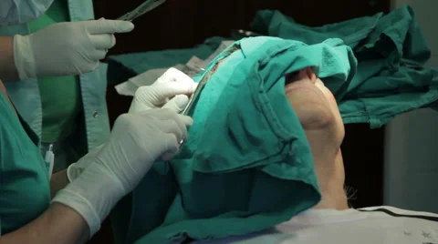 Maxillofacial surgery. Removing mole. Stitching, suture, needle, close up. Stock Footage 52706623