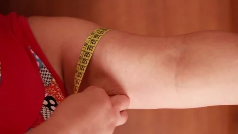 Measuring cellulite arm with tape Stock Footage 81057261