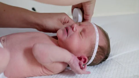 Measuring Newborns Head Circumference Stock Footage 311656145