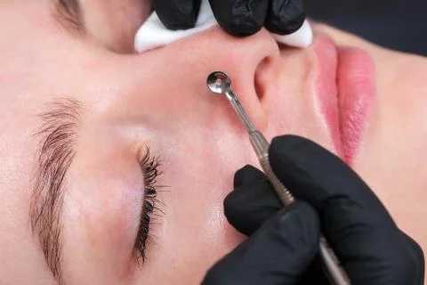 Mechanical cleaning of the face with extractor Stock Photos