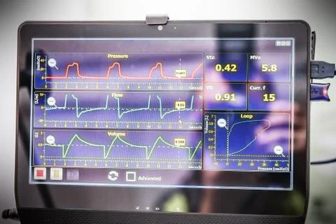 Mechanical ventilation equipment Stock Photos