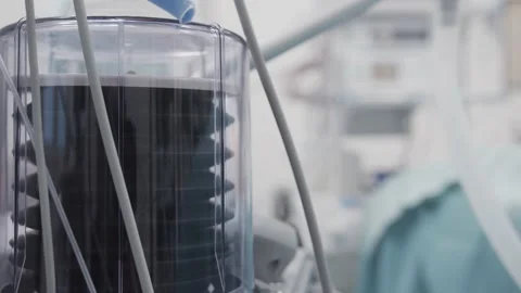 Mechanical Ventilator Working in ICU hospital Helping People to Breathe Stock Footage