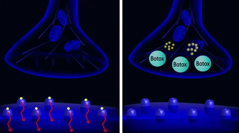 Mechanism of Botox action Stock Footage 37345804
