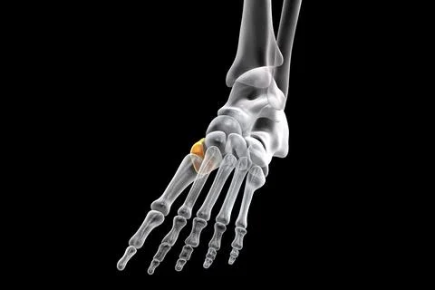 Medial cuneiform bone of the foot, 3D illustration Stock Illustration
