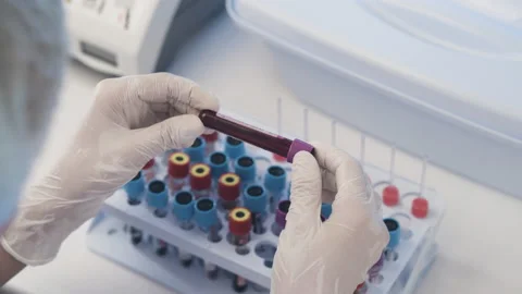 The Medic Carefully Examines the Test Tubes With Blood Samples. Concept Stock Footage 176970846