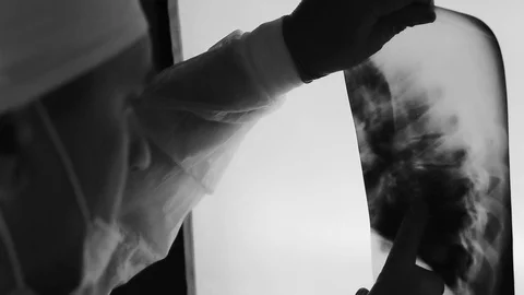 The medic looks at the x ray Stock Footage 127572857