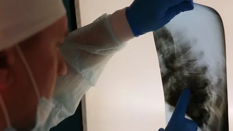 A medic looks at an x ray Stock Footage 127572933