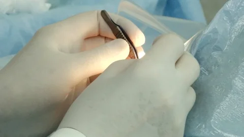 Medic operation Stock Footage 103188593