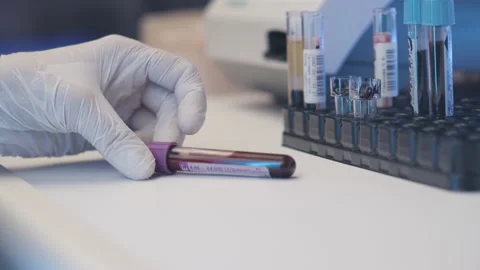 The Medic Puts a Test Tubes With Blood Samples on The Table. Medical research Stock Footage 195239849