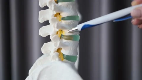 Medic shows problems of the spine Video stock 170601639