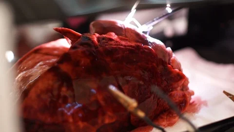 Medic students training a puncture Stock Footage 87254084