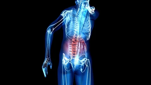 Medical 3d animation of lower back spine pain of human male having acute pain in Video stock 336580237